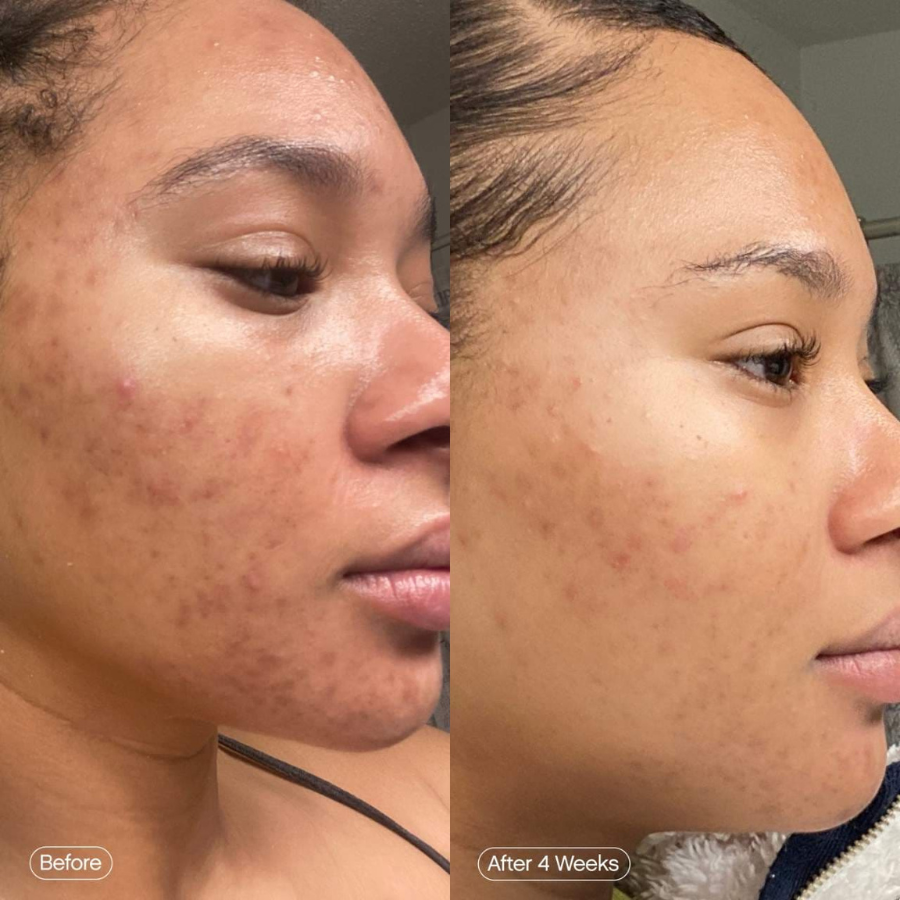 Topicals Faded Brightening and Clearing Serum