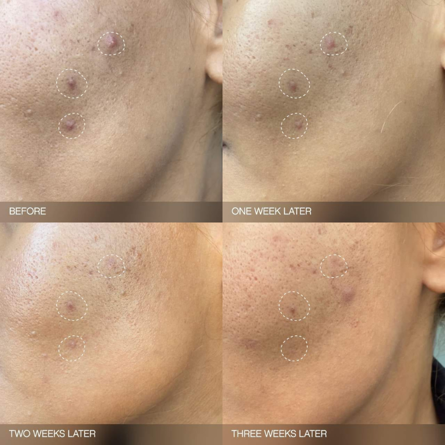 Topicals Faded Brightening and Clearing Serum