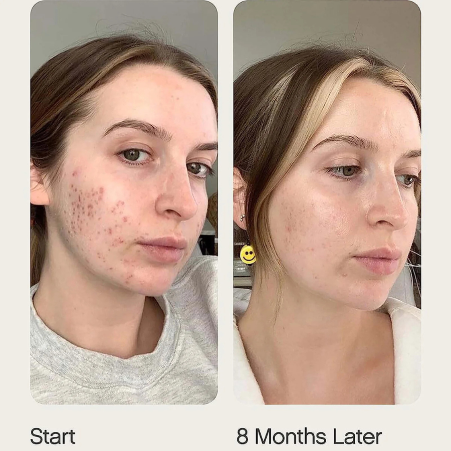 Topicals Faded Brightening and Clearing Serum
