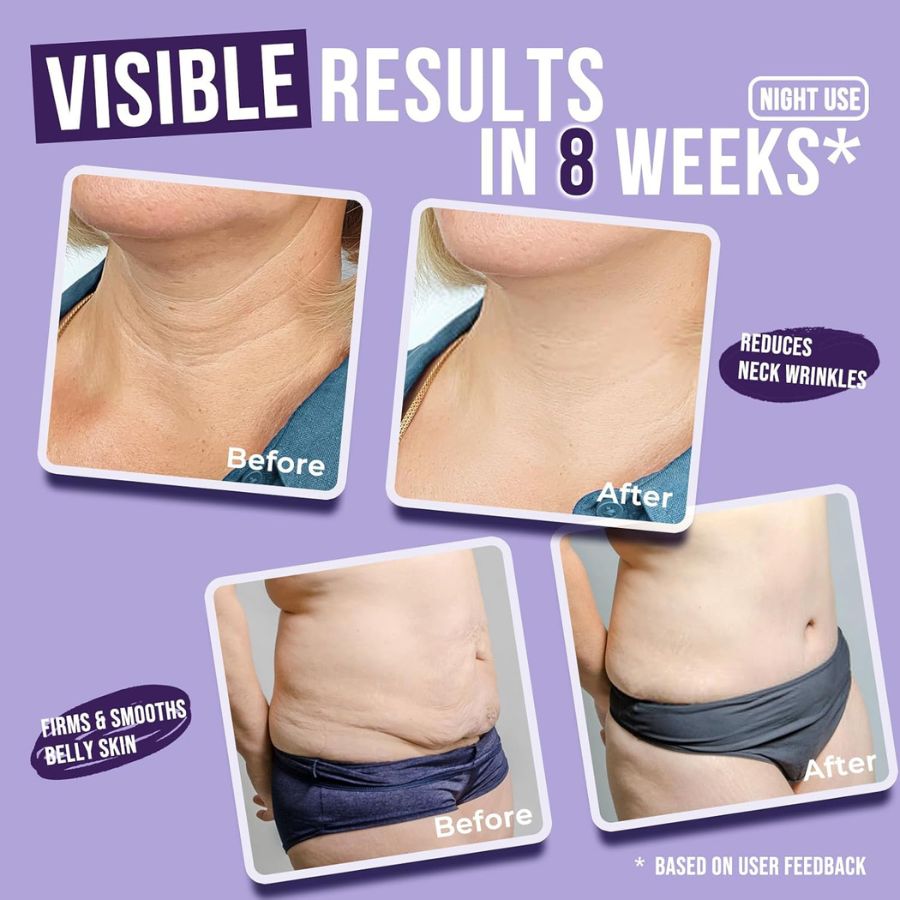 Get Dreamy Overnight Toning Whip - SkinViral
