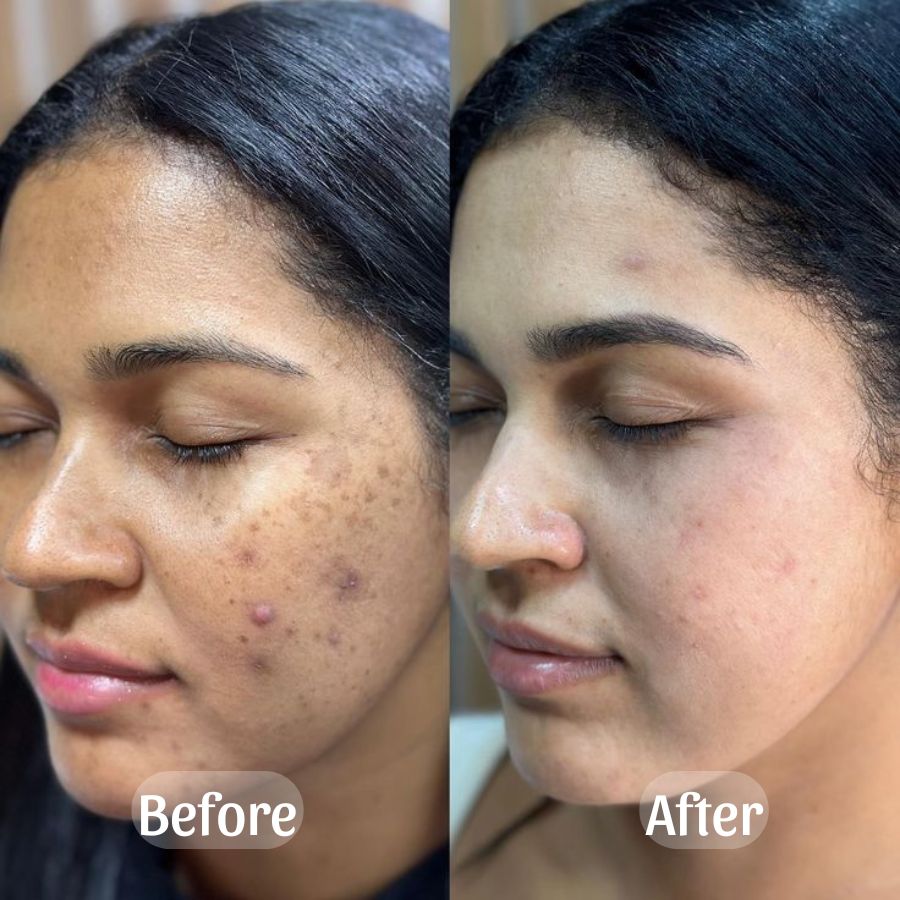 Recovery Mud Mask - SkinViral