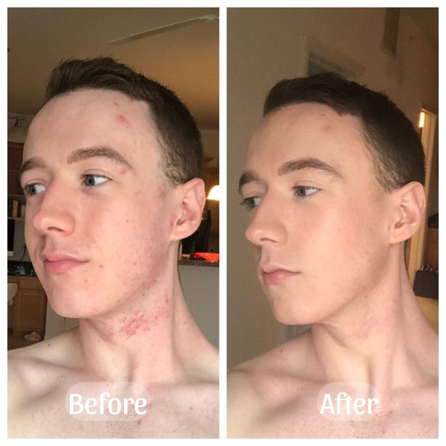Recovery Mud Mask - SkinViral