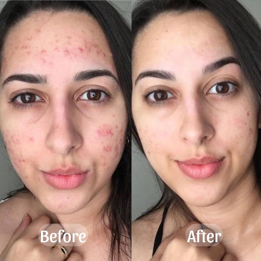 Recovery Mud Mask - SkinViral