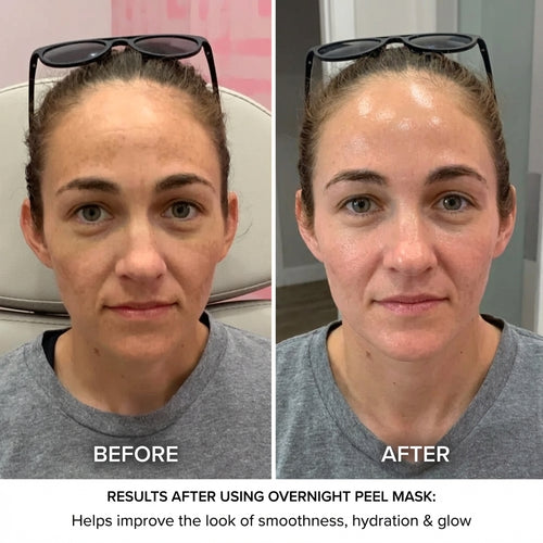 Kojic Acid Turmeric Peel Off Mask Overnight Glow