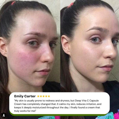 Deep Vita C Capsule Cream - SkinViral
