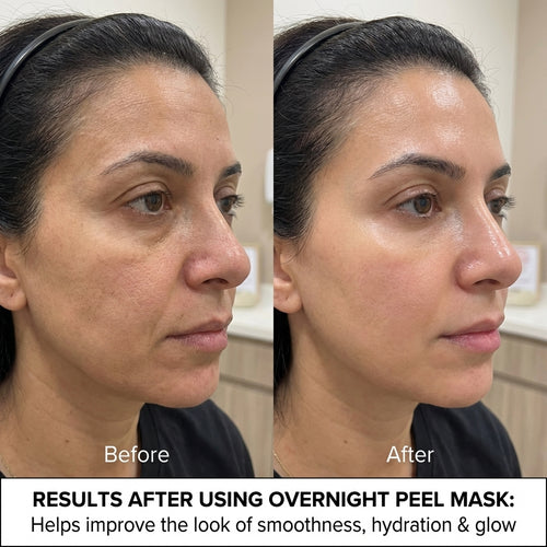 Kojic Acid Turmeric Peel Off Mask Overnight Glow