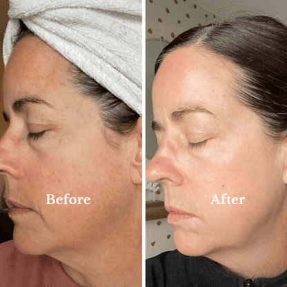 PDRN Pink Collagen Capsule Cream - SkinViral