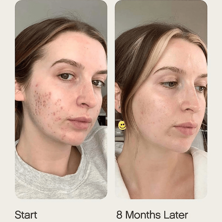 Topicals Faded Brightening and Clearing Serum 1.7OZ/50ML(NEW VERSION) (Buy 1 Get 1 Free) - SkinViral